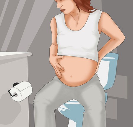 Bệnh trĩ khi mang thai và cách phòng tránh
